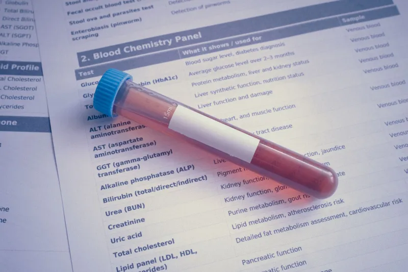 Your Lab Results Say Success—So Why Is Gout Still Attacking Your Joints?
